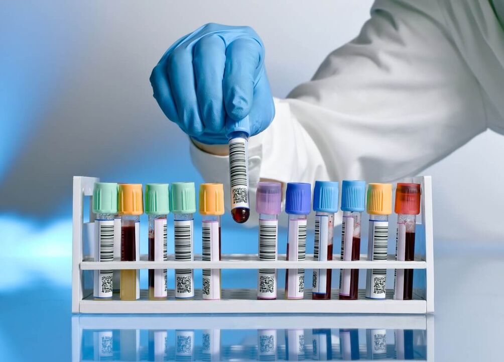 blood test to detect abnormal secretions during arousal